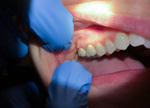 Best Same-Day Emergency Dentist in Lake Tansi, TN